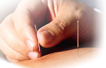 Acupuncture For Palm Harbor Acupuncture Clinic